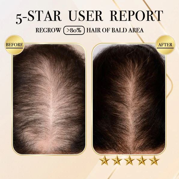 HairBar™ - Haarwuchs Ingwer Shampoo Bar | 1+1 GRATIS!
