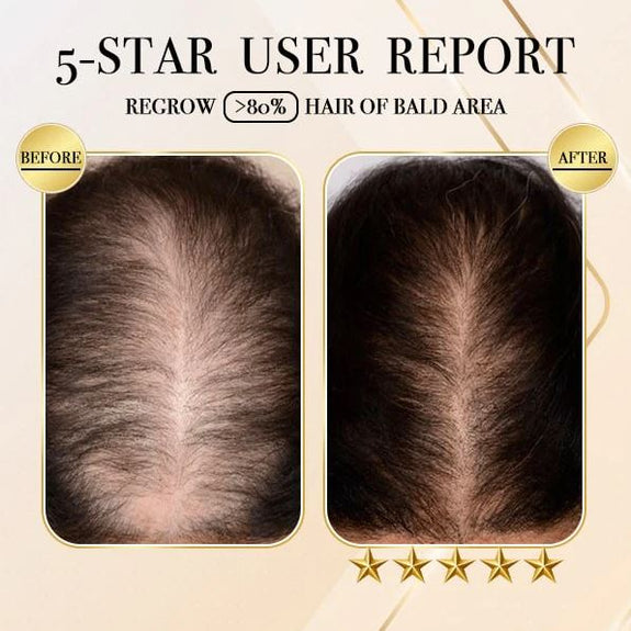 HairSoap™ - Haarseifenstück | 1+1 GRATIS!