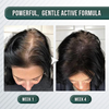 HairLive™ - Centella Scrub für sofortigen Haarwuchs